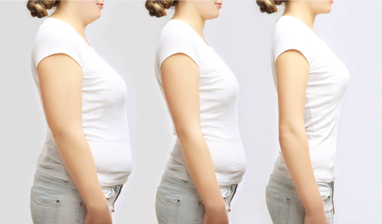 donna fasi perdita di peso dimagrimento senza dieta